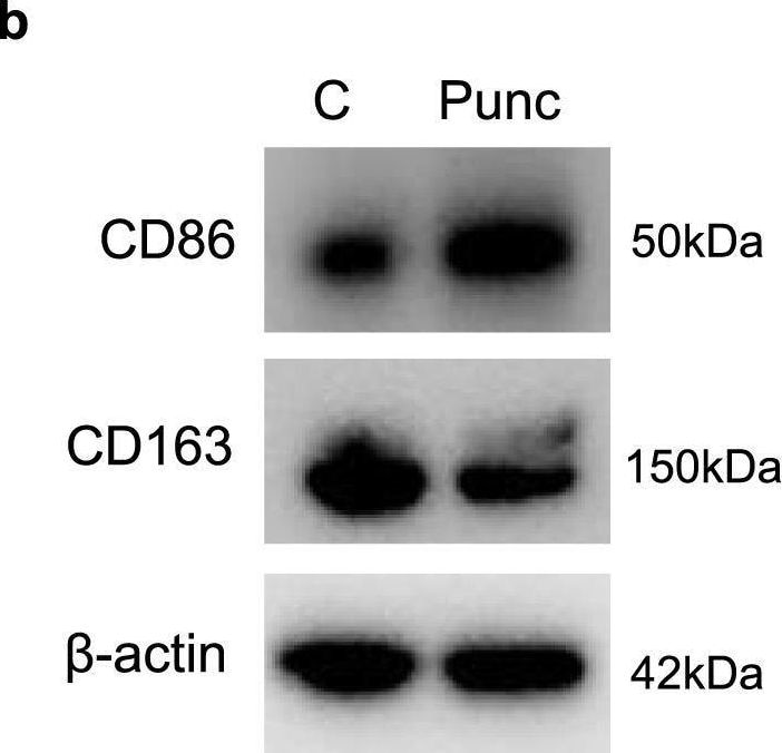 B7-2/CD86 Antibody (BU63)