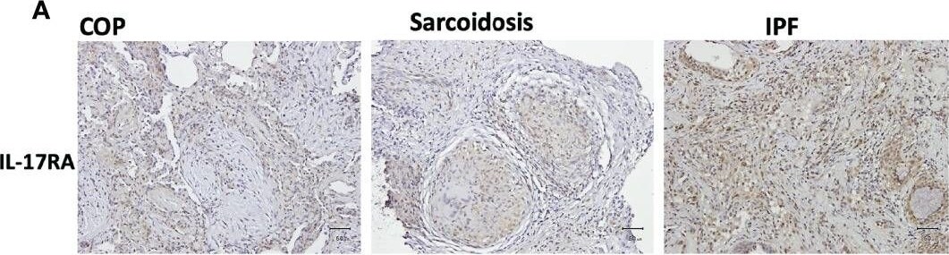 IL-17RA/IL-17R Antibody (49M4D2) - BSA Free