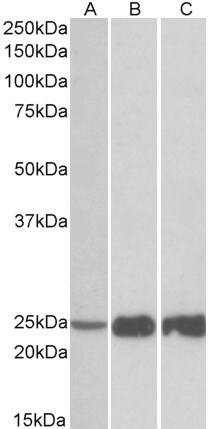 Troponin I type 2 (fast skeletal) Antibody