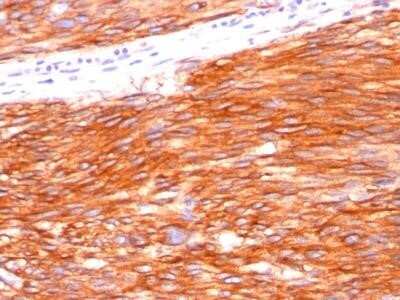 CD117/c-kit Antibody (C117/370)