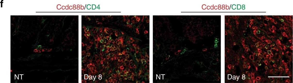 CD8 Antibody