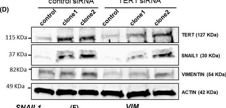 Snail Antibody - BSA Free