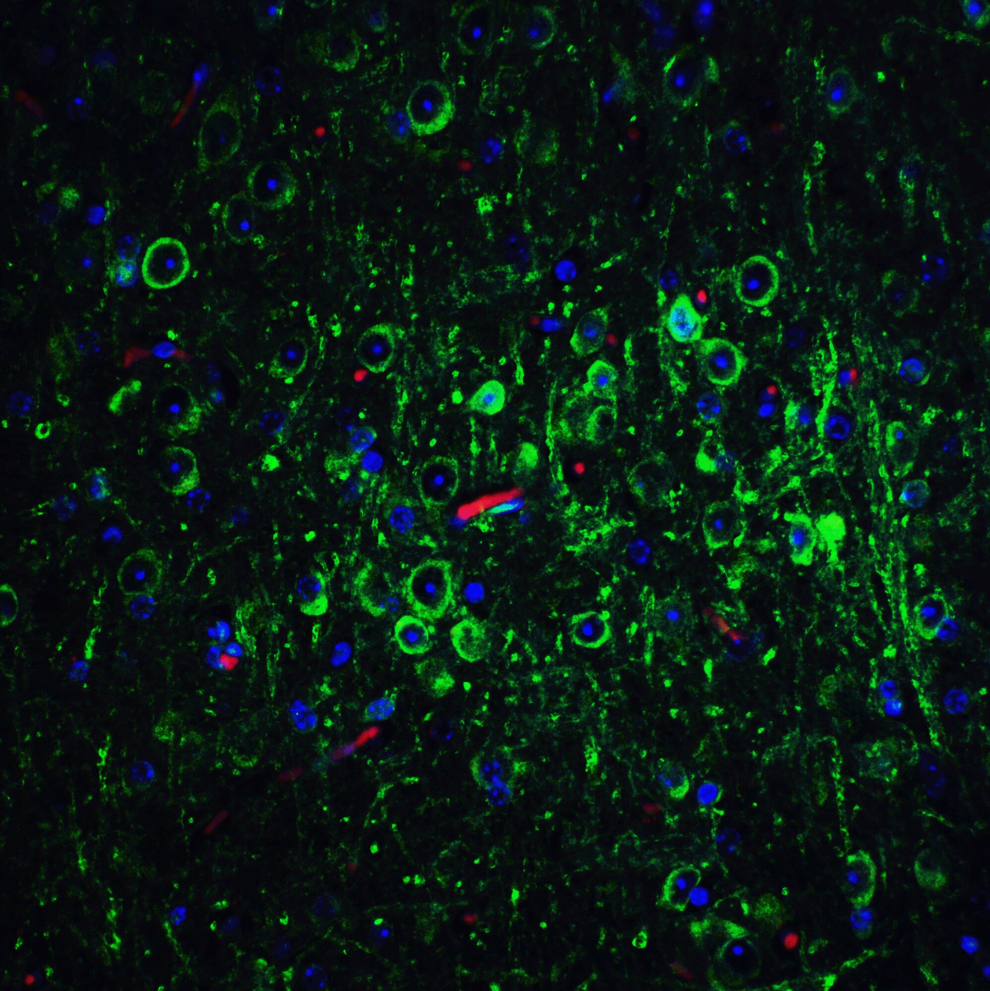 Bcl-2 Antibody - BSA Free