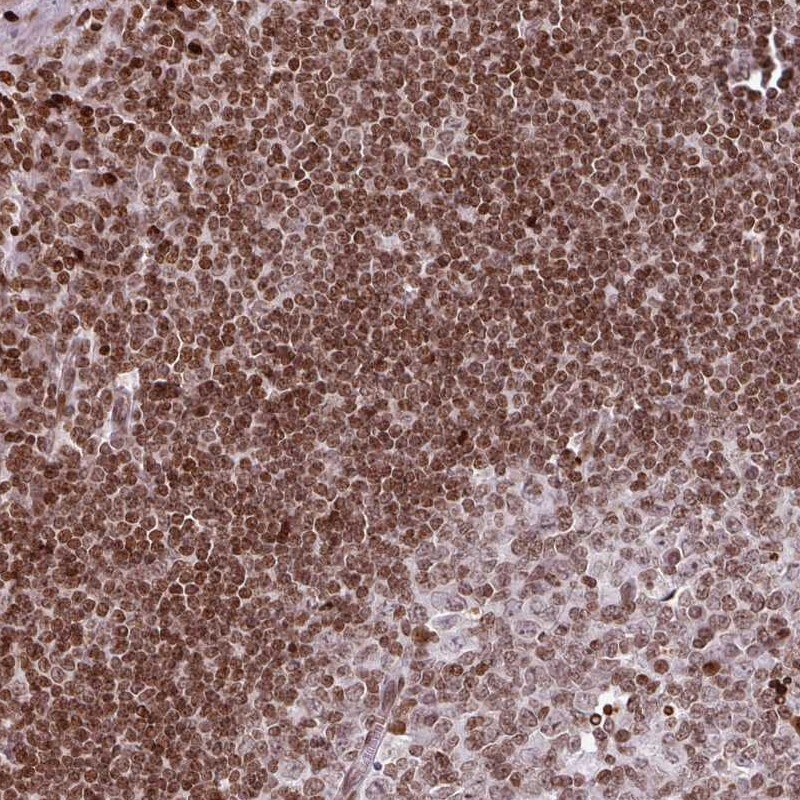 RASL11A Antibody - BSA Free Immunohistochemistry-Paraffin: RASL11A Antibody [NBP2-30368]