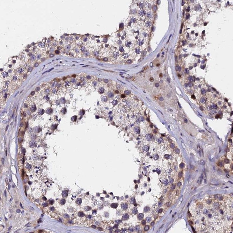 GPN3 Antibody - BSA Free Immunohistochemistry-Paraffin: GPN3 Antibody [NBP2-30372]