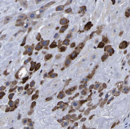 LEPRE1 Antibody LEPRE1 Antibody
