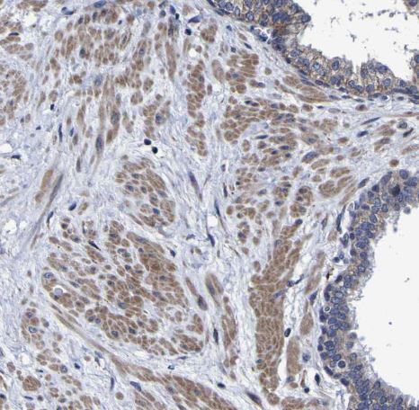 LEPRE1 Antibody LEPRE1 Antibody