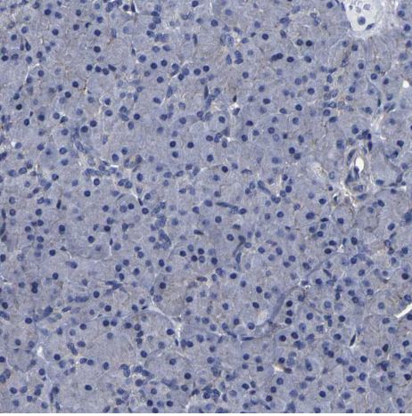 LEPRE1 Antibody LEPRE1 Antibody