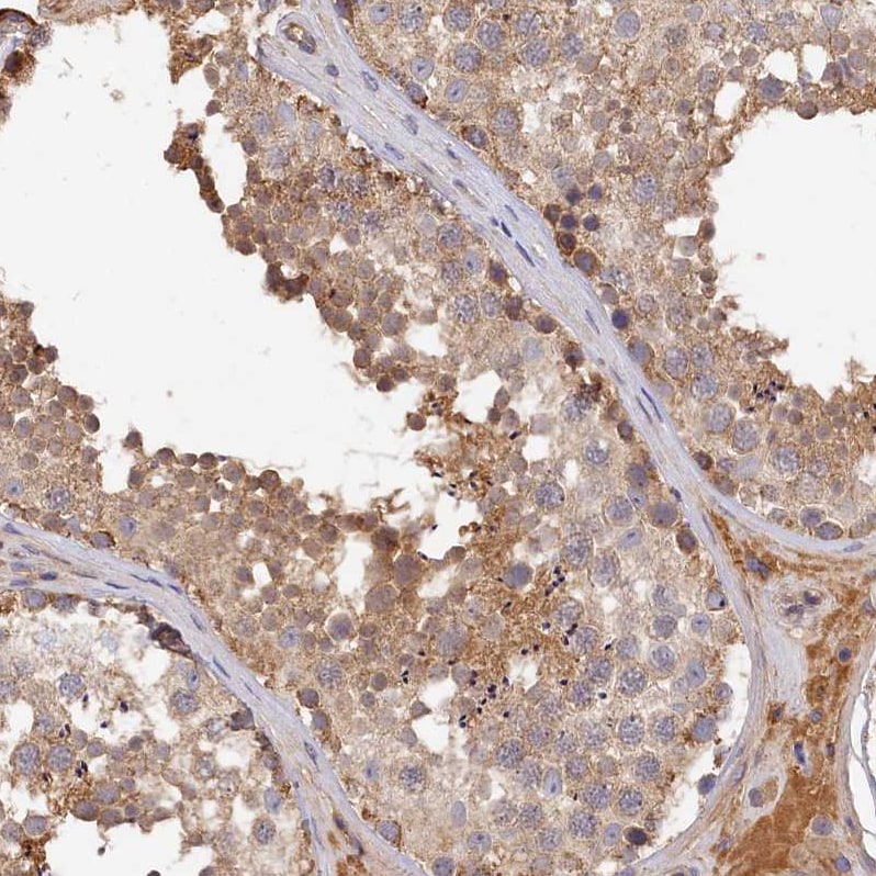 MGC4172 Antibody - BSA Free Immunohistochemistry-Paraffin: MGC4172 Antibody [NBP2-30446]