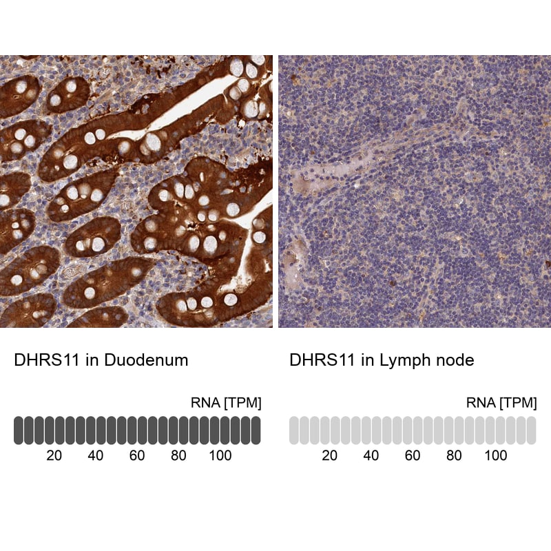 MGC4172 Antibody - BSA Free Immunohistochemistry-Paraffin: MGC4172 Antibody [NBP2-30446]