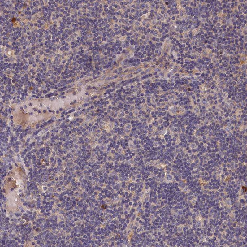 MGC4172 Antibody - BSA Free Immunohistochemistry-Paraffin: MGC4172 Antibody [NBP2-30446]