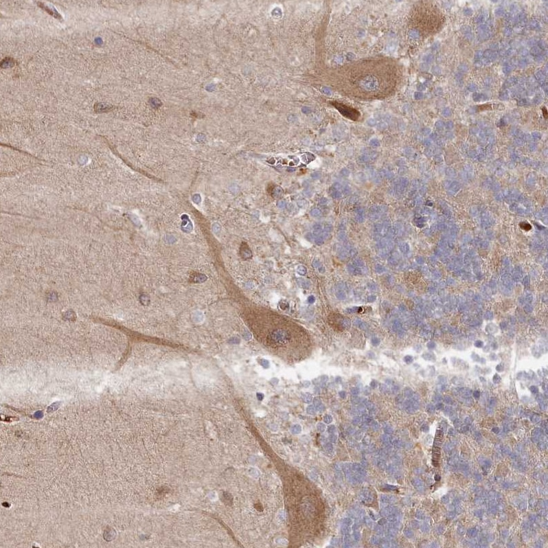MGC4172 Antibody - BSA Free Immunohistochemistry-Paraffin: MGC4172 Antibody [NBP2-30446]