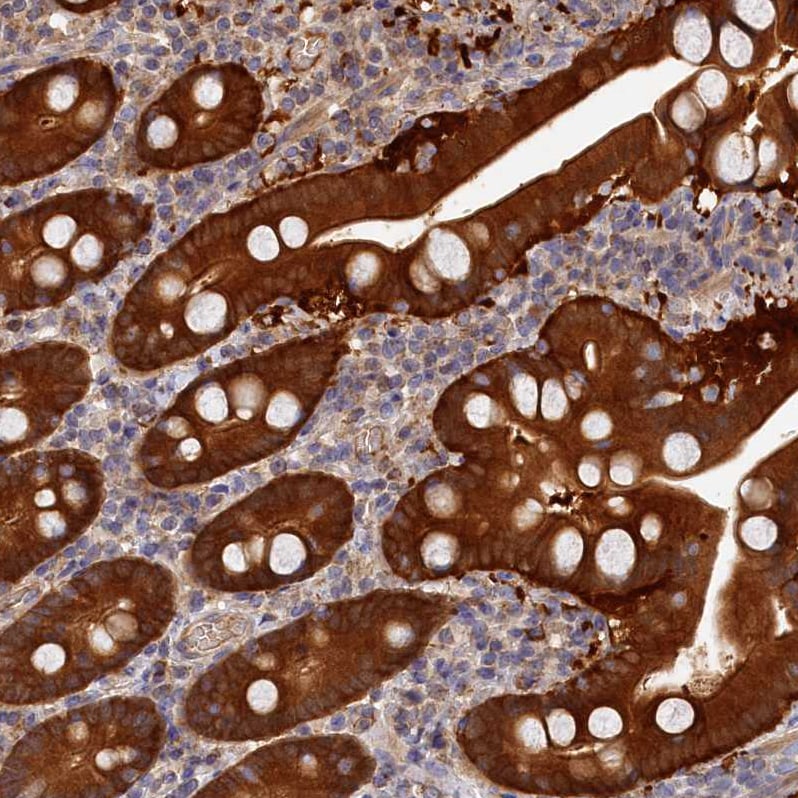 MGC4172 Antibody - BSA Free Immunohistochemistry-Paraffin: MGC4172 Antibody [NBP2-30446]