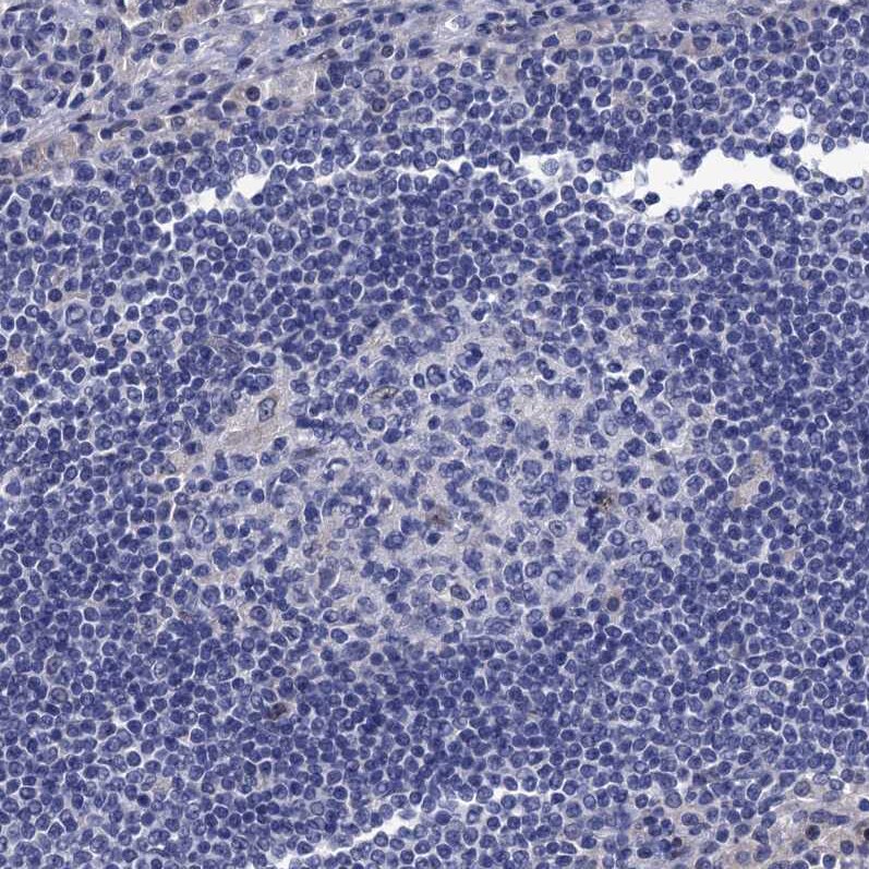 Mindin/Spondin-2 Antibody - BSA Free Immunohistochemistry-Paraffin: Mindin/Spondin-2 Antibody [NBP2-30500]