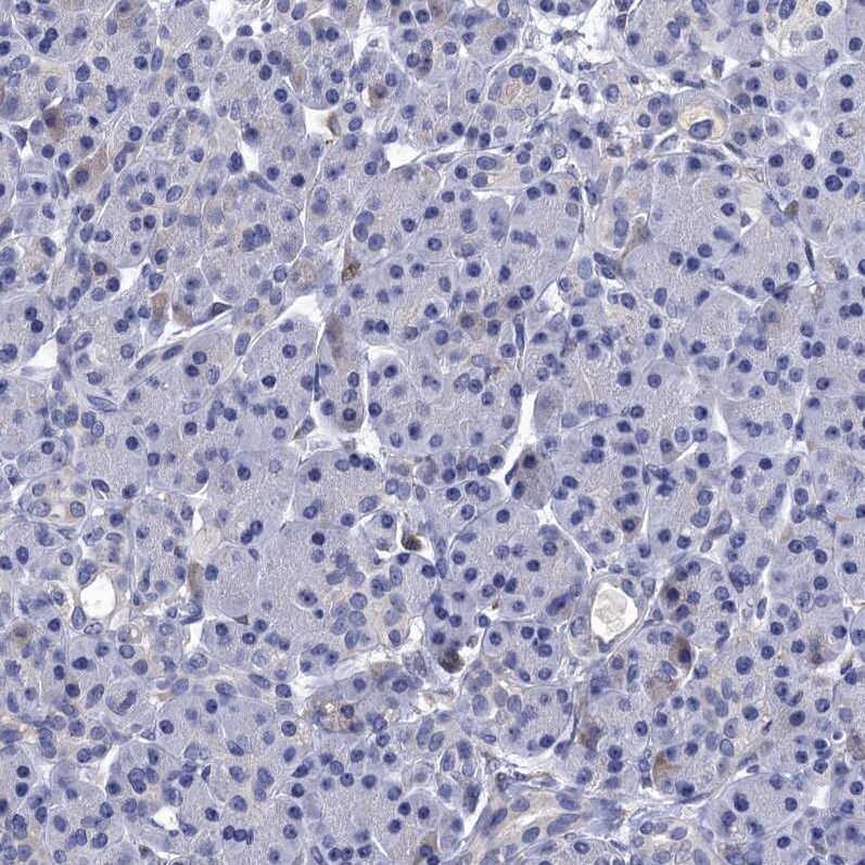 Mindin/Spondin-2 Antibody - BSA Free Immunohistochemistry-Paraffin: Mindin/Spondin-2 Antibody [NBP2-30500]
