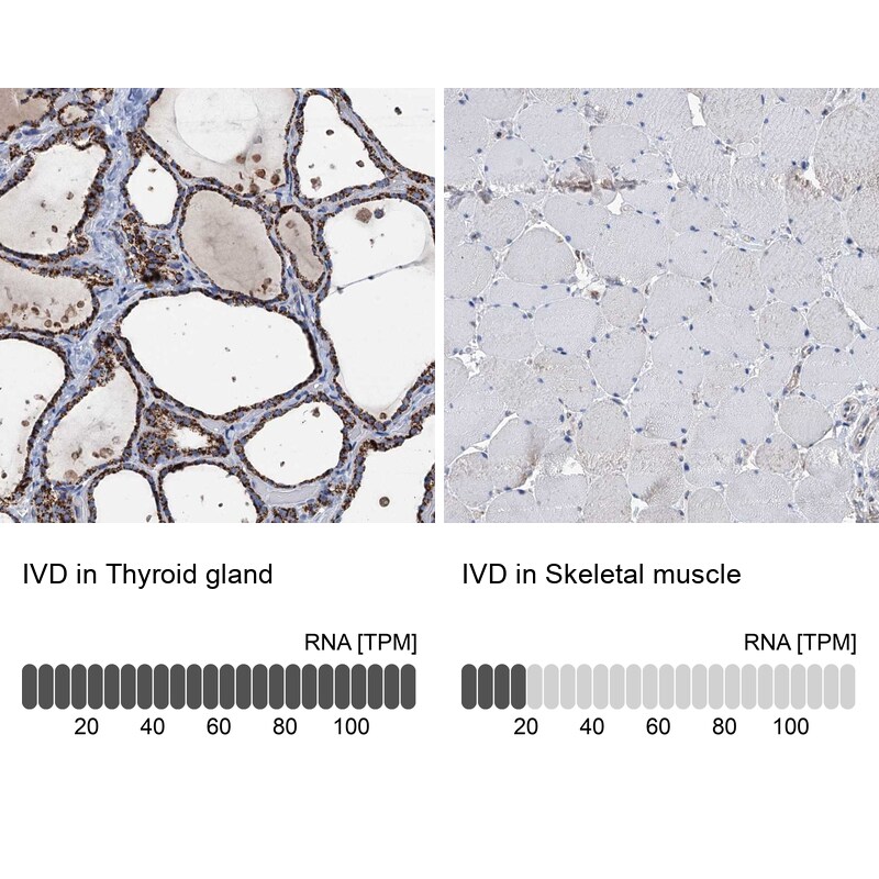IVD Antibody - BSA Free Immunohistochemistry-Paraffin: IVD Antibody [NBP2-30578]