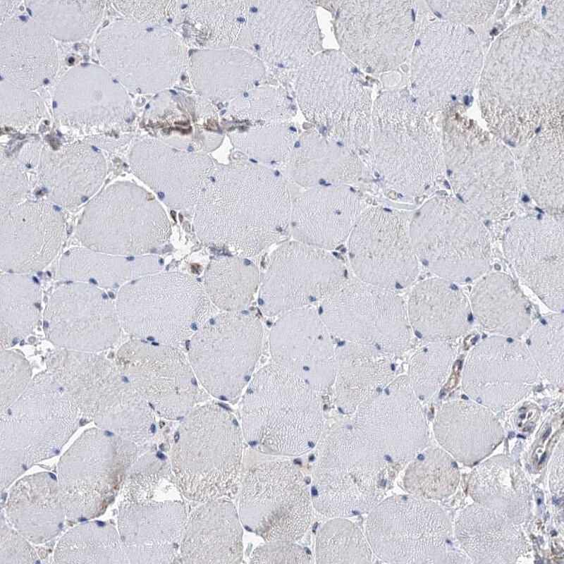 IVD Antibody - BSA Free Immunohistochemistry-Paraffin: IVD Antibody [NBP2-30578]