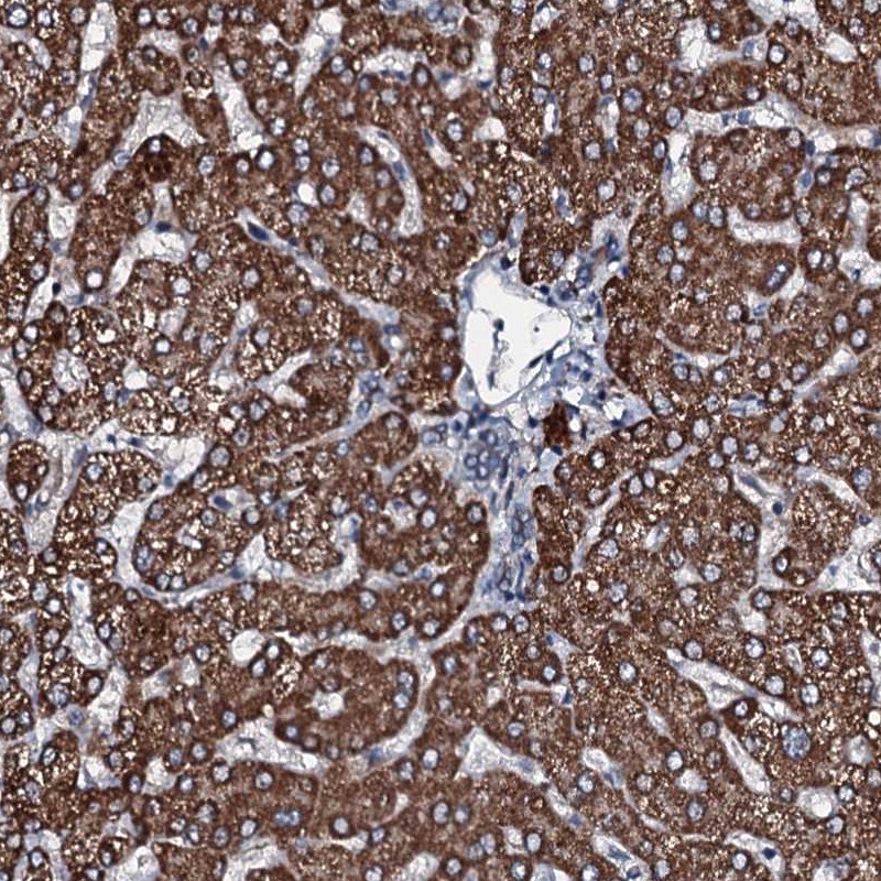 FLJ21963 Antibody - BSA Free Immunohistochemistry-Paraffin: FLJ21963 Antibody [NBP2-30585]
