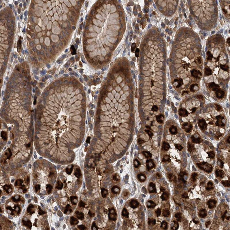 LOH12CR1 Antibody - BSA Free Immunohistochemistry-Paraffin: LOH12CR1 Antibody [NBP2-30597]