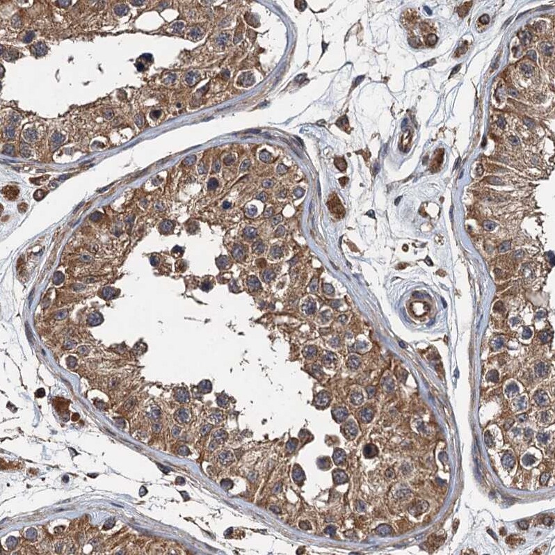 LOH12CR1 Antibody - BSA Free Immunohistochemistry-Paraffin: LOH12CR1 Antibody [NBP2-30597]