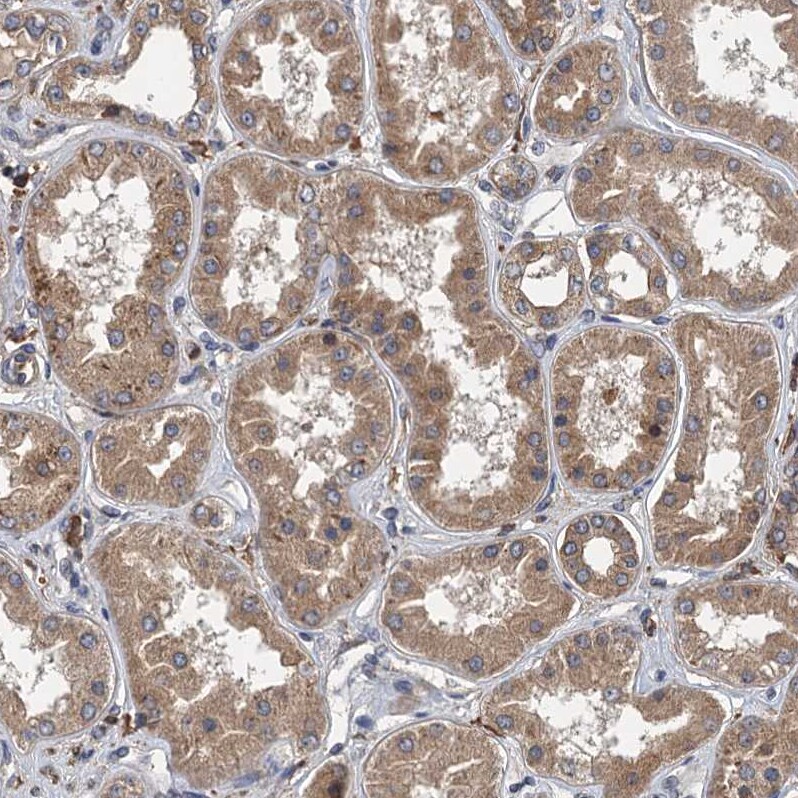 LOH12CR1 Antibody - BSA Free Immunohistochemistry-Paraffin: LOH12CR1 Antibody [NBP2-30597]