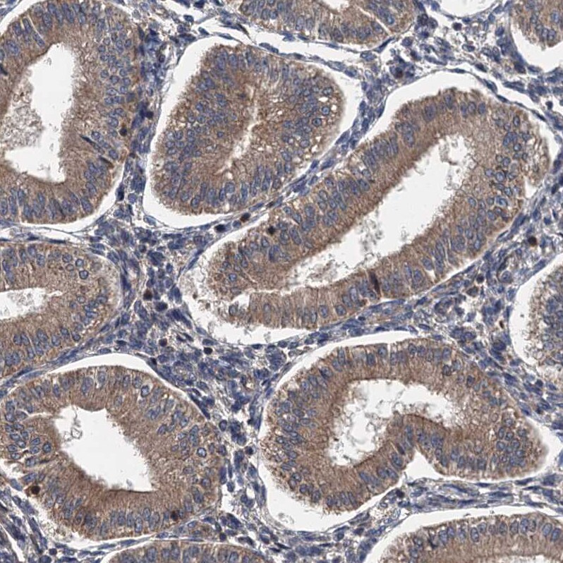 LOH12CR1 Antibody - BSA Free Immunohistochemistry-Paraffin: LOH12CR1 Antibody [NBP2-30597]