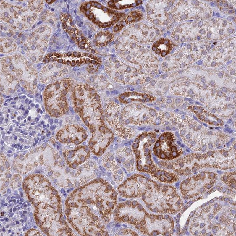 ACSS1 Antibody - BSA Free Immunohistochemistry-Paraffin: ACSS1 Antibody [NBP2-30612]