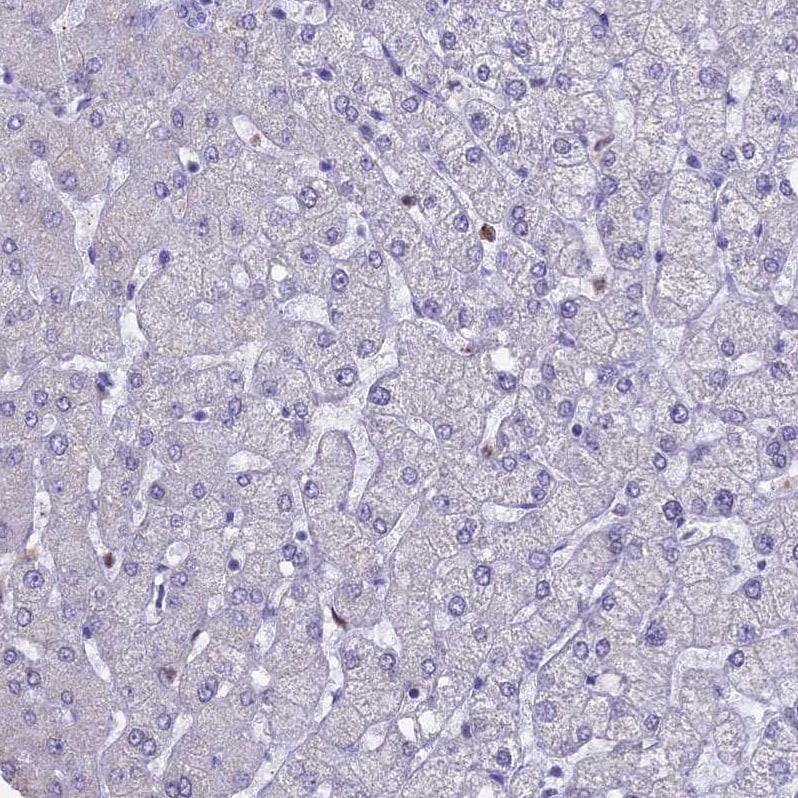 ACSS1 Antibody - BSA Free Immunohistochemistry-Paraffin: ACSS1 Antibody [NBP2-30612]