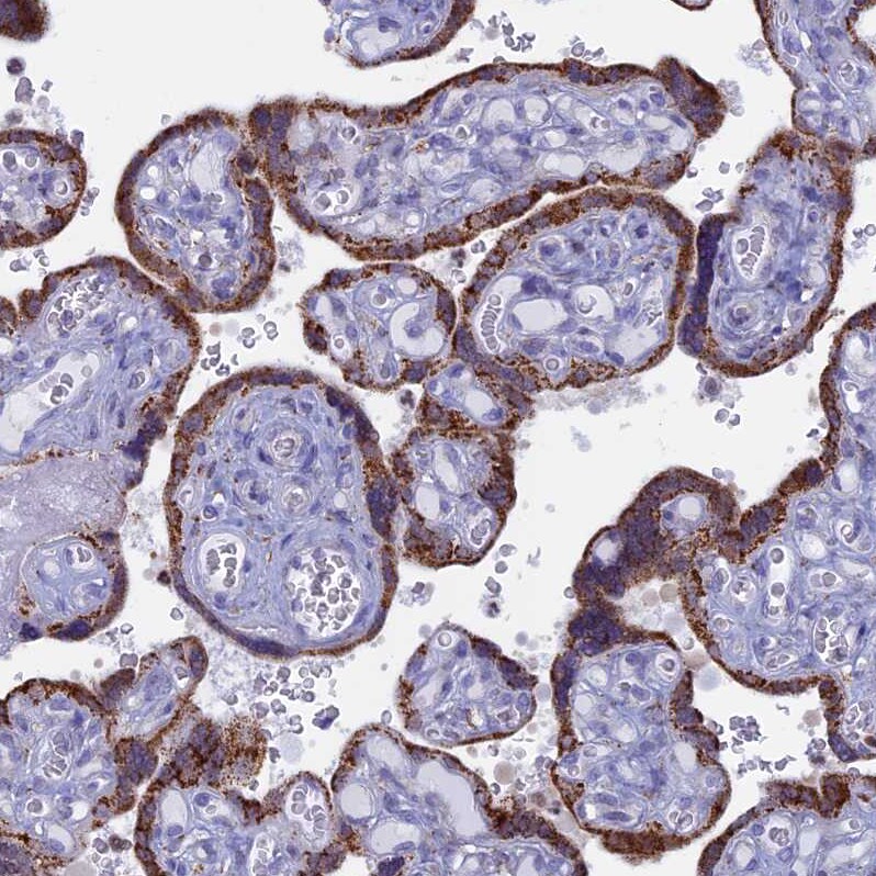 ACSS1 Antibody - BSA Free Immunohistochemistry-Paraffin: ACSS1 Antibody [NBP2-30612]