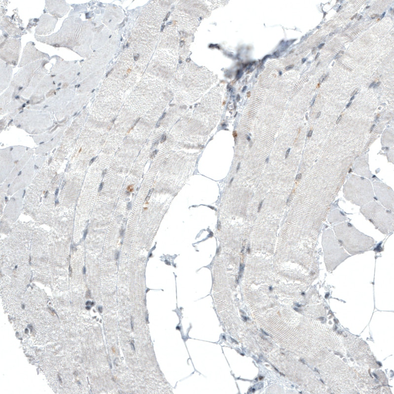BAF180/PB1 Antibody (CL0331) - BSA Free Immunohistochemistry: BAF180/PB1 Antibody (CL0331) - BSA Free [NBP2-30673]