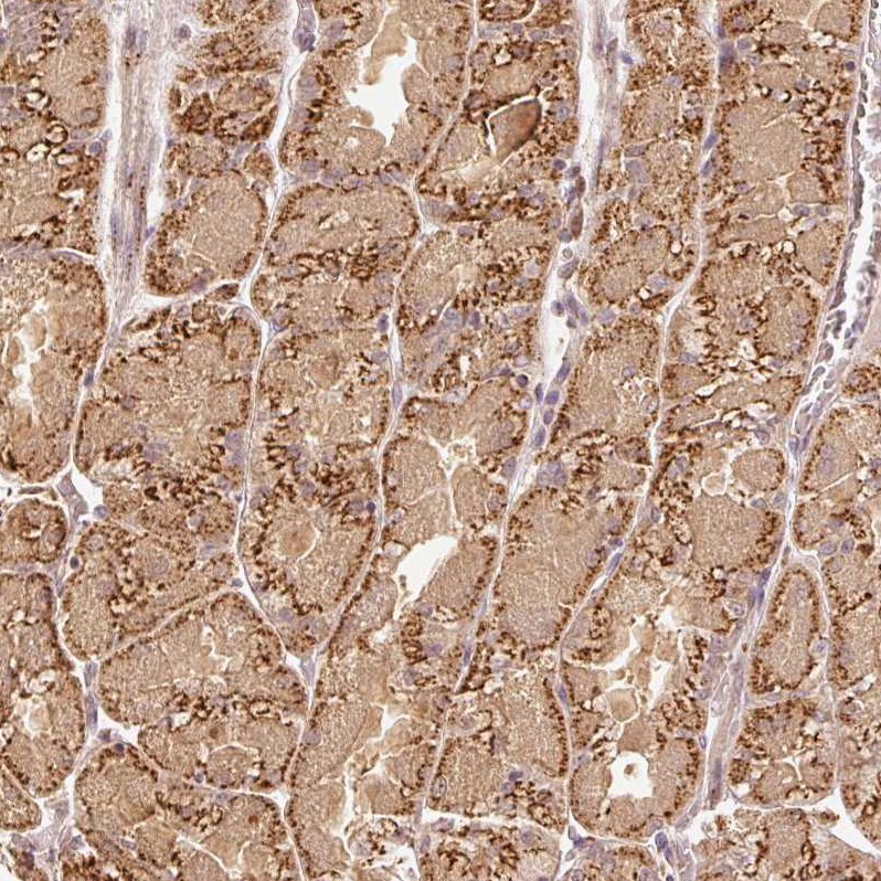 Fucosyltransferase 8/FUT8 Antibody - BSA Free Immunohistochemistry: Fucosyltransferase 8/FUT8 Antibody - BSA Free [Fucosyltransferase 8/FUT8 Antibody - BSA Free]