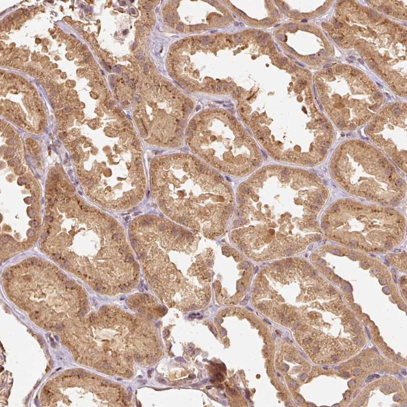 Fucosyltransferase 8/FUT8 Antibody - BSA Free Immunohistochemistry: Fucosyltransferase 8/FUT8 Antibody - BSA Free [Fucosyltransferase 8/FUT8 Antibody - BSA Free]