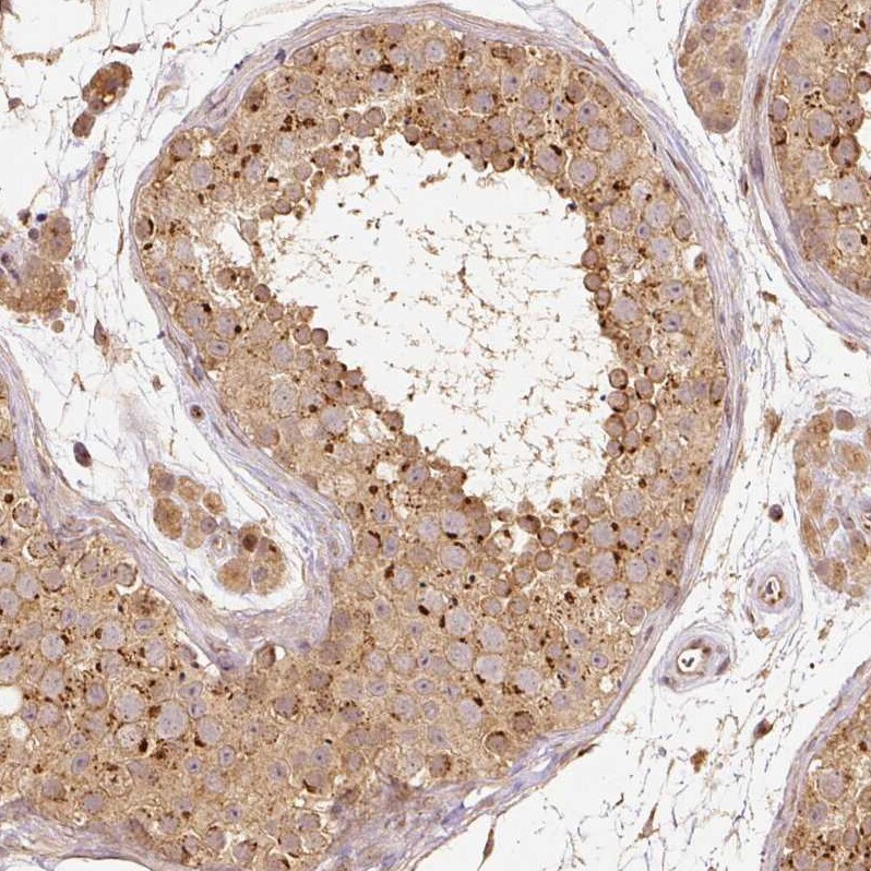Fucosyltransferase 8/FUT8 Antibody - BSA Free Immunohistochemistry: Fucosyltransferase 8/FUT8 Antibody - BSA Free [Fucosyltransferase 8/FUT8 Antibody - BSA Free]