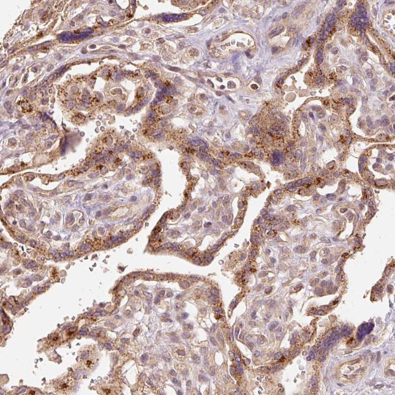 Fucosyltransferase 8/FUT8 Antibody - BSA Free Immunohistochemistry: Fucosyltransferase 8/FUT8 Antibody - BSA Free [Fucosyltransferase 8/FUT8 Antibody - BSA Free]