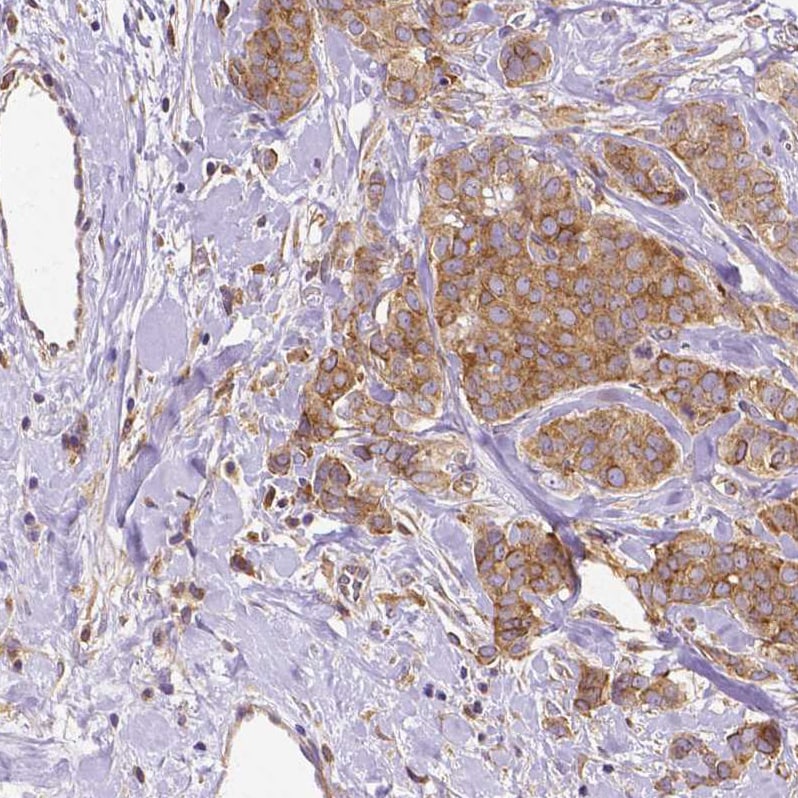 Dicer Antibody (CL0378) - BSA Free Immunohistochemistry: Dicer Antibody (CL0378) - BSA Free [NBP2-30699]