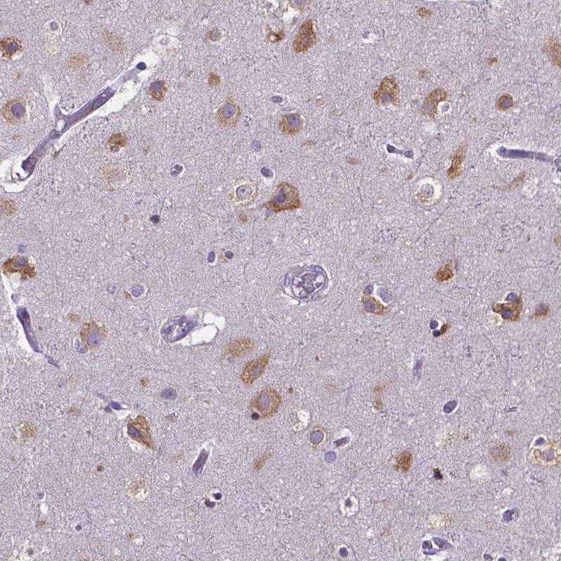 Dicer Antibody (CL0378) - BSA Free Immunohistochemistry: Dicer Antibody (CL0378) - BSA Free [NBP2-30699]