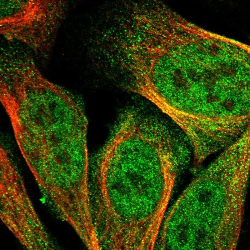 DSCAM Antibody - BSA Free Immunocytochemistry/ Immunofluorescence: DSCAM Antibody [NBP2-30716]