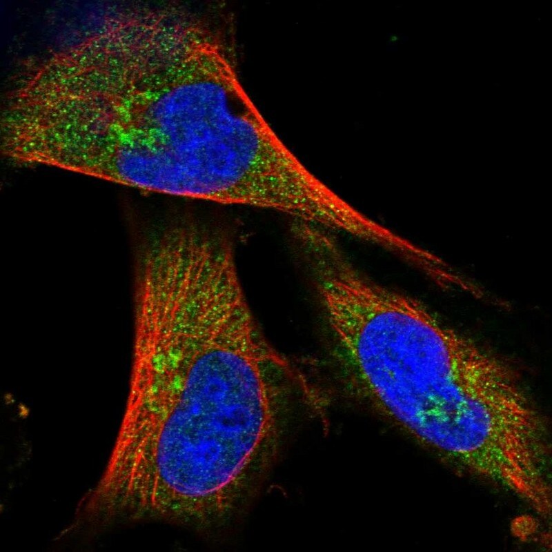 COG4 Antibody - BSA Free Immunocytochemistry/ Immunofluorescence: COG4 Antibody [NBP2-30718]