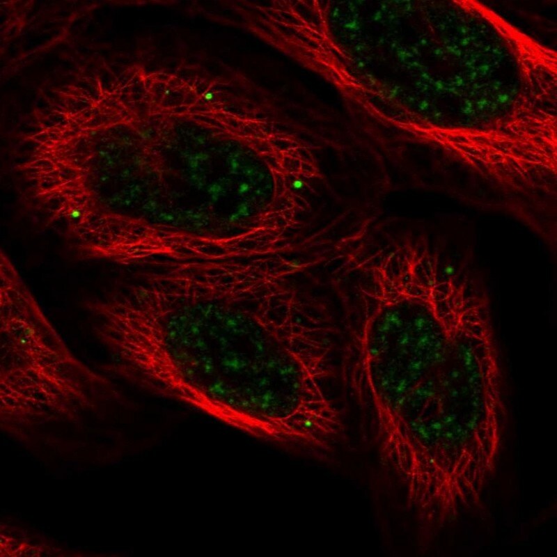 HECTD4 Antibody - BSA Free Immunocytochemistry/ Immunofluorescence: HECTD4 Antibody [NBP2-30719]