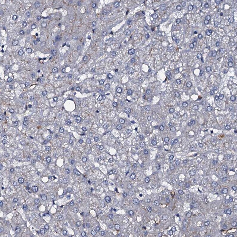 CLEC14A Antibody - BSA Free Immunohistochemistry-Paraffin: CLEC14A Antibody [NBP2-30854]