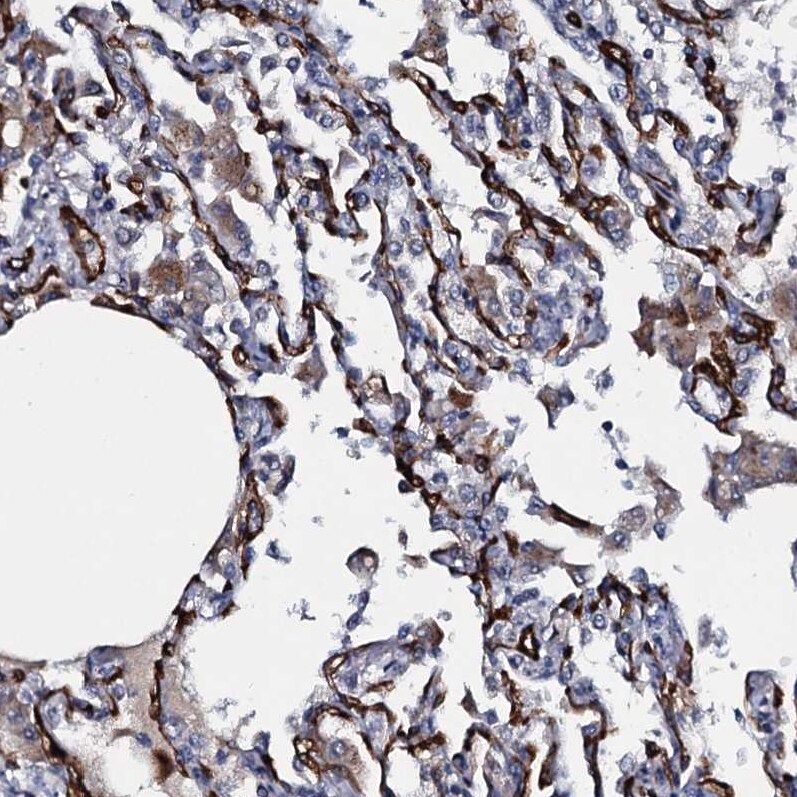 CLEC14A Antibody - BSA Free Immunohistochemistry-Paraffin: CLEC14A Antibody [NBP2-30854]