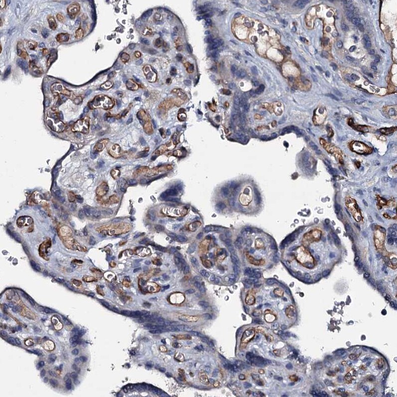 CLEC14A Antibody - BSA Free Immunohistochemistry-Paraffin: CLEC14A Antibody [NBP2-30854]