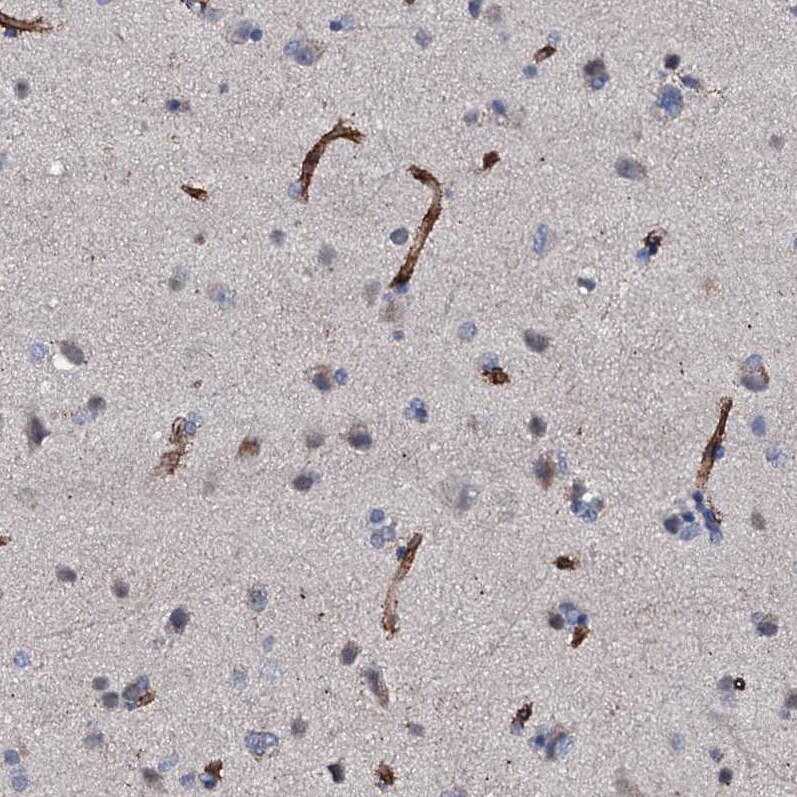 CLEC14A Antibody - BSA Free Immunohistochemistry-Paraffin: CLEC14A Antibody [NBP2-30854]