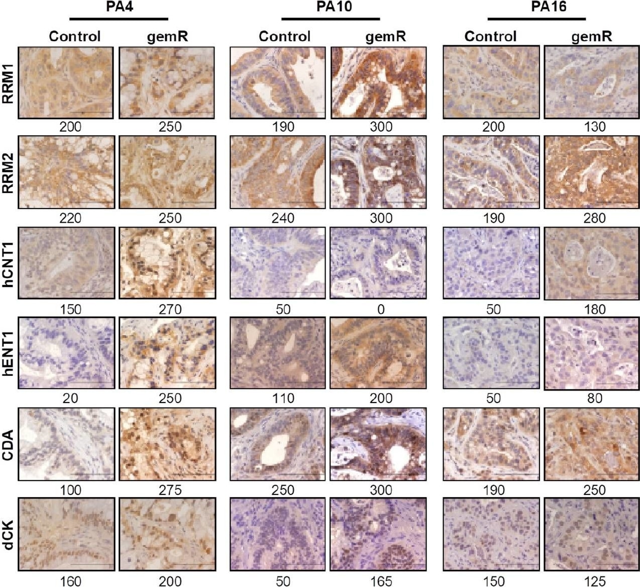 SLC28A1 Antibody
