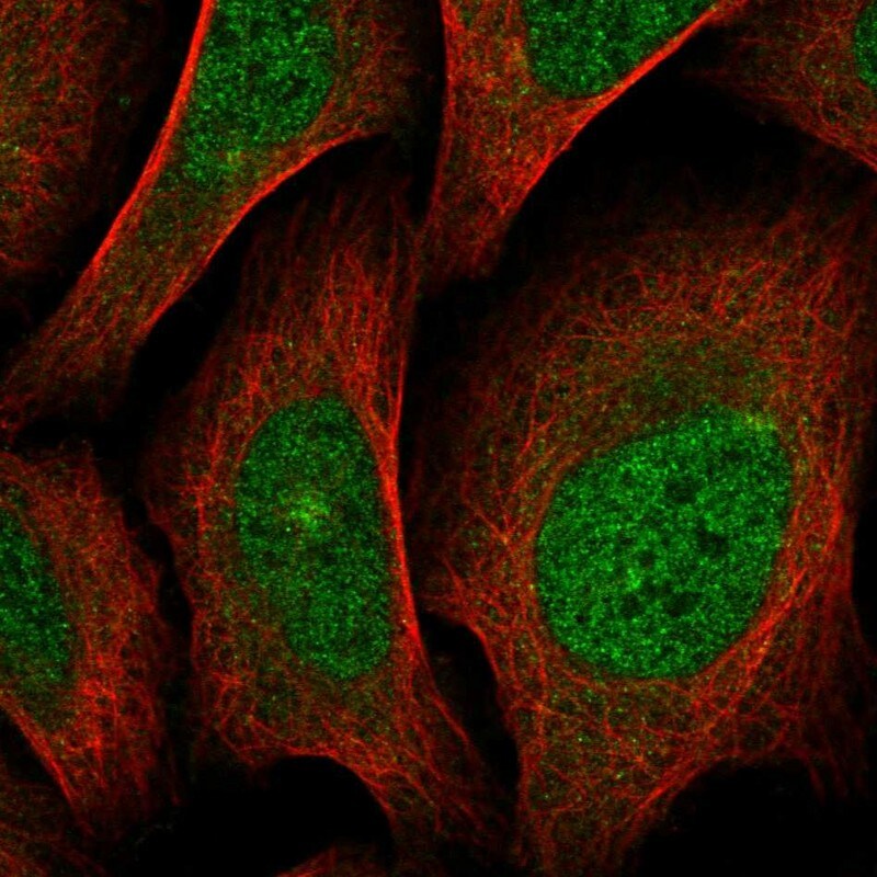 SCN4A Antibody Immunocytochemistry/ Immunofluorescence: SCN4A Antibody [NBP2-30861]