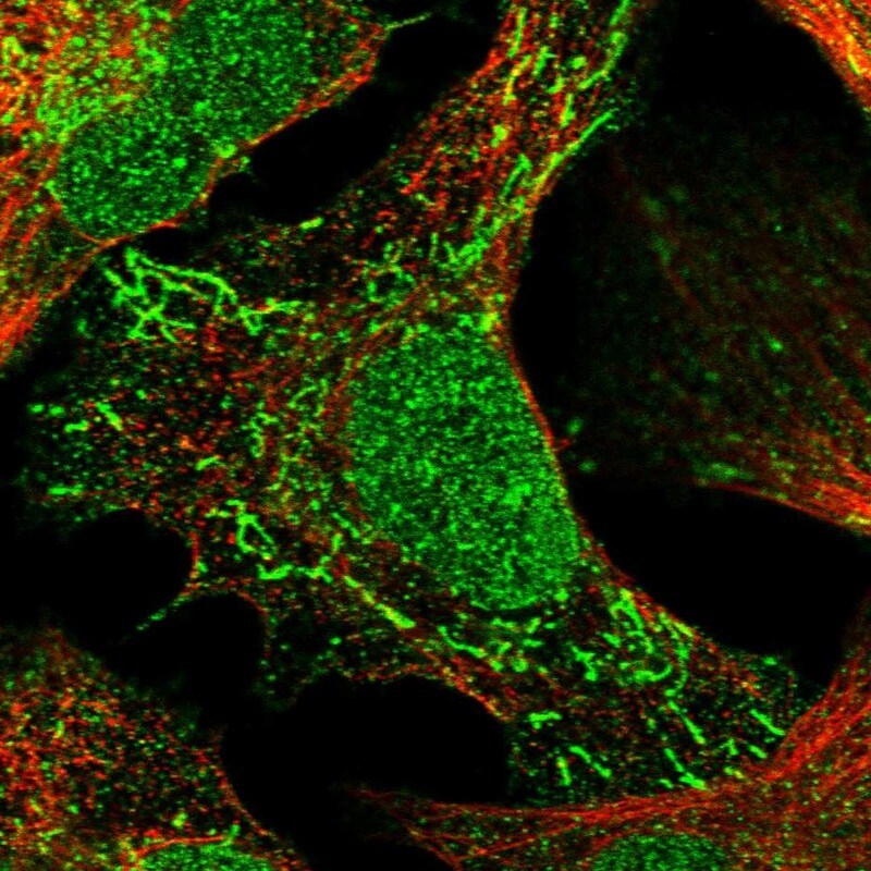 Trinucleotide Repeat Containing 18 Antibody - BSA Free Immunocytochemistry/ Immunofluorescence: Trinucleotide Repeat Containing 18 Antibody [NBP2-30890]