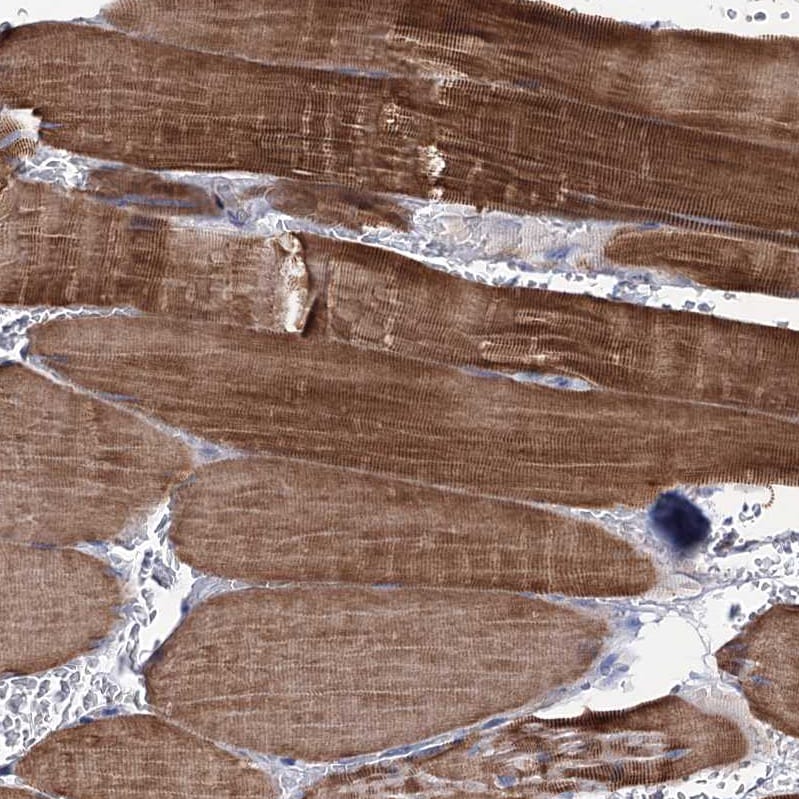 EPB41L5 Antibody - BSA Free Immunohistochemistry-Paraffin: EPB41L5 Antibody [NBP2-30920]