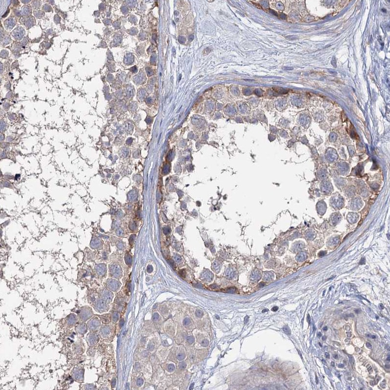 EPB41L5 Antibody - BSA Free Immunohistochemistry-Paraffin: EPB41L5 Antibody [NBP2-30920]