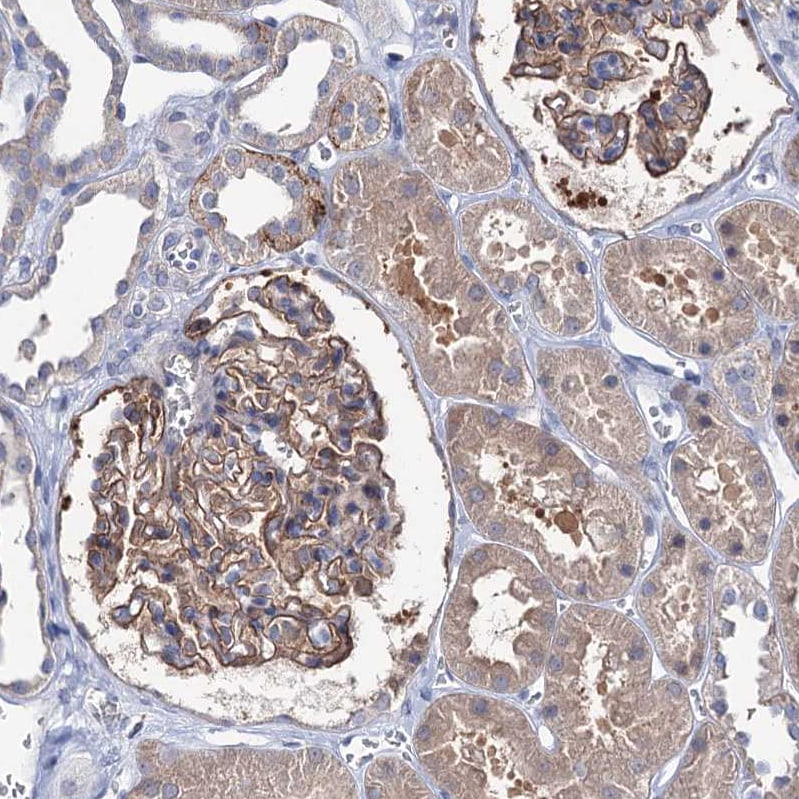 EPB41L5 Antibody - BSA Free Immunohistochemistry-Paraffin: EPB41L5 Antibody [NBP2-30920]