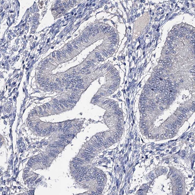 EPB41L5 Antibody - BSA Free Immunohistochemistry-Paraffin: EPB41L5 Antibody [NBP2-30920]